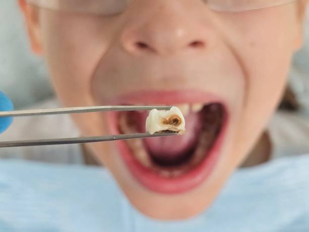 Best Broken or Cracked Tooth Emergency Dentist in Waveland, MS
